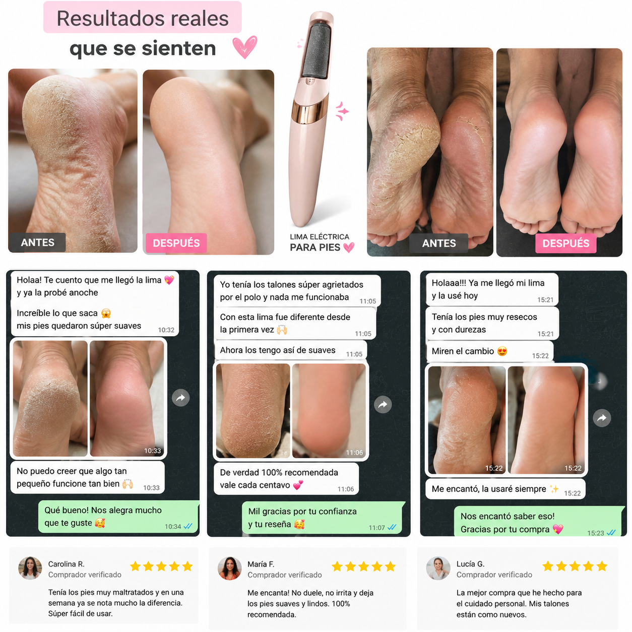 Removedor de Callos Recargable