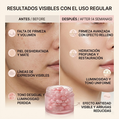 PDRN PINK: ADN de Salmón, Cápsulas de Colágeno y Niacinamida 5%