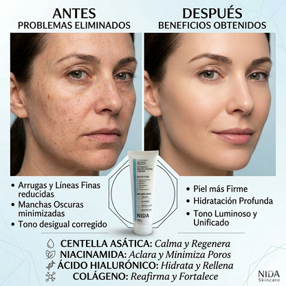 NIDA Botox Sin Agujas